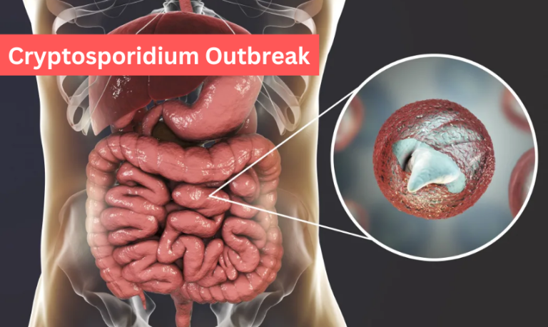 Understanding the Cryptosporidium Outbreak in Queenstown: A Comprehensive Guide to Stay Safe